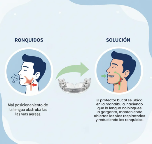 Protector Dental Para Bruxismo y Ronquidos