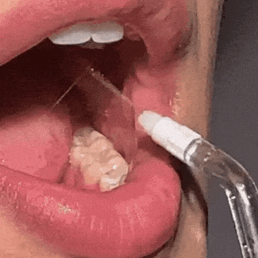 Irrigador Bucal Inalámbrico