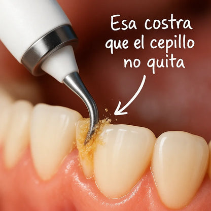 Removedor de Sarro ✨ Elimina placa y cálculos sin salir de casa